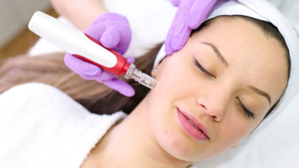 Face Micro needling in Bayside melbourne